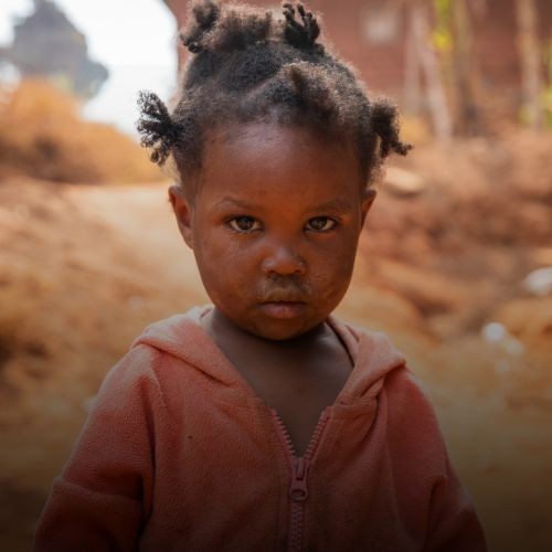 Desnutrição e Desigualdade: Uma Crise Humanitária Ignorada